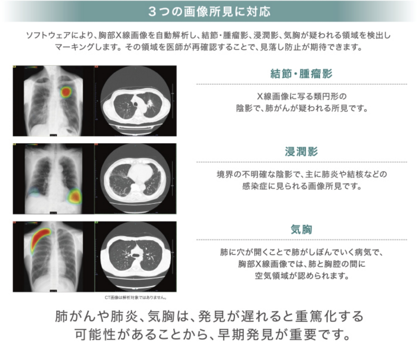 AI技術を用いたレントゲン検査(CXR-AID)を開始しました - 眞内科クリニック｜静岡市清水区の内科・デイサービス